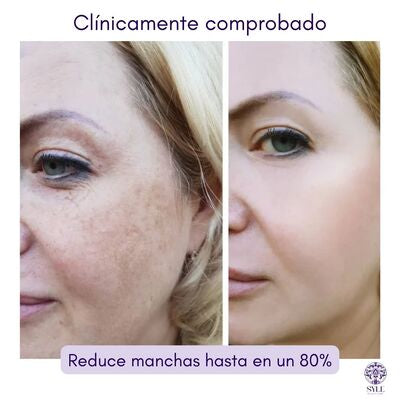 Sérum Vitamina C y Acido Hialuronico- SYLE BEAUTY CARE ®