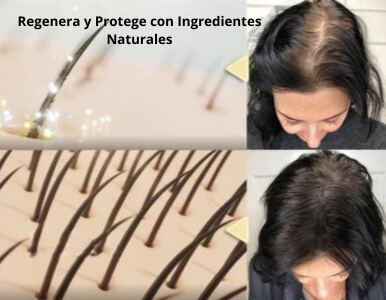 SERUM DE JENGIBRE®  - Serum contra la caida del cabello.